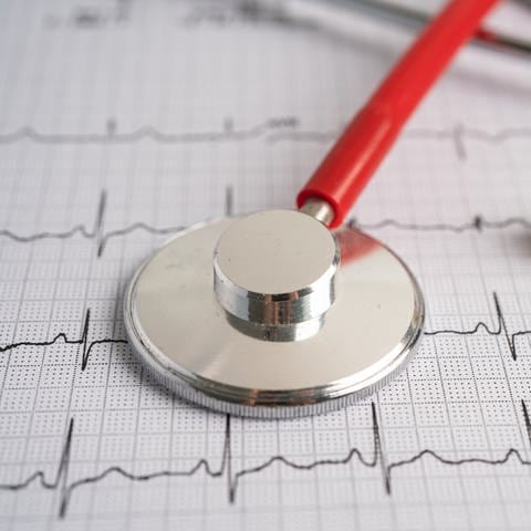 Ein Stethoskop liegt auf einem Elektrokardiogramm (EKG).