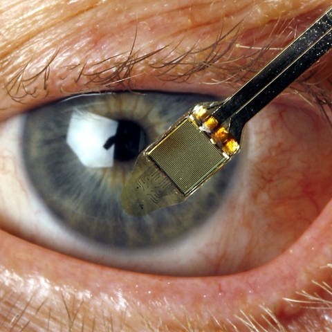Eine Person hält einen Chip vor das Auge einer blinden Person.