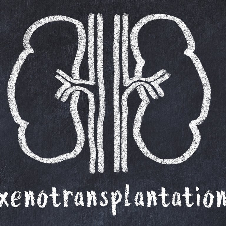 Symbolbild: Kreidezeichnung von Nieren und medizinischer Begriff Xenotransplantation (Foto: IMAGO, IMAGO / Pond5 Images)