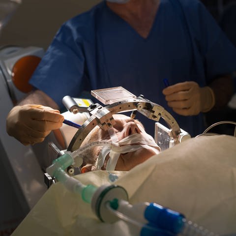 Ein Patient liegt im Operationssaal und wird für eine Gehirn-Operation vorbereitet. 