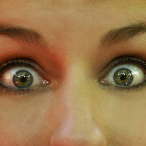 Eine Frau mit weit aufgerissenen Augen. (Foto: IMAGO, IMAGO / McPHOTO)