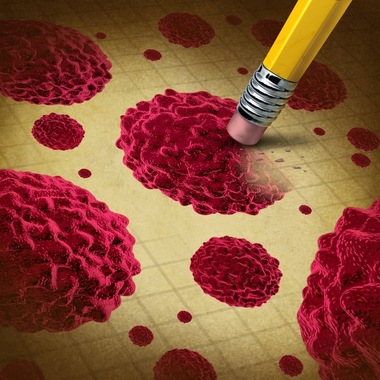 Zeichnung: Krebsbehandlung mit Zellen, die sich als bösartige Wucherung im menschlichen Körper ausbreiten und wachsen - zeigt einen Radiergummi, der die Krankheit beseitigt (Foto: IMAGO, IMAGO / YAY Images)