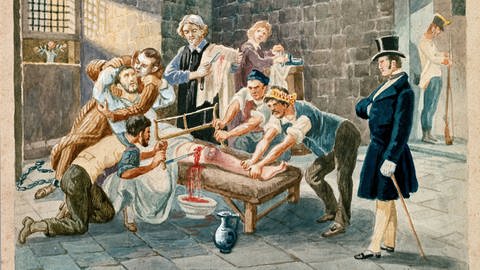 Le patriote et membre de la Carboneria (carbonarisme) Pietro Maroncelli (1795-1846) est ampute de la jambe lors de son emprisonnement dans le penitencier de la forteresse de Spielberg en Moravie (Foto: IMAGO,  imago stock&people)