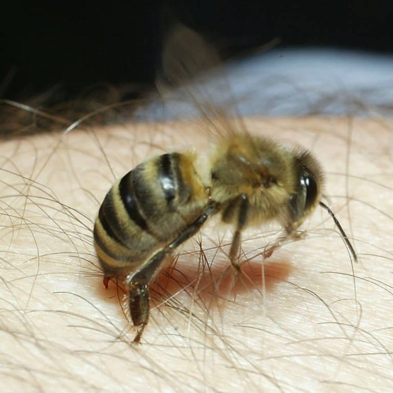 Eine Biene sticht einen Mann in den Arm (Foto: picture-alliance / Reportdienste, picture-alliance/ dpa/dpaweb | Thomas Frey)