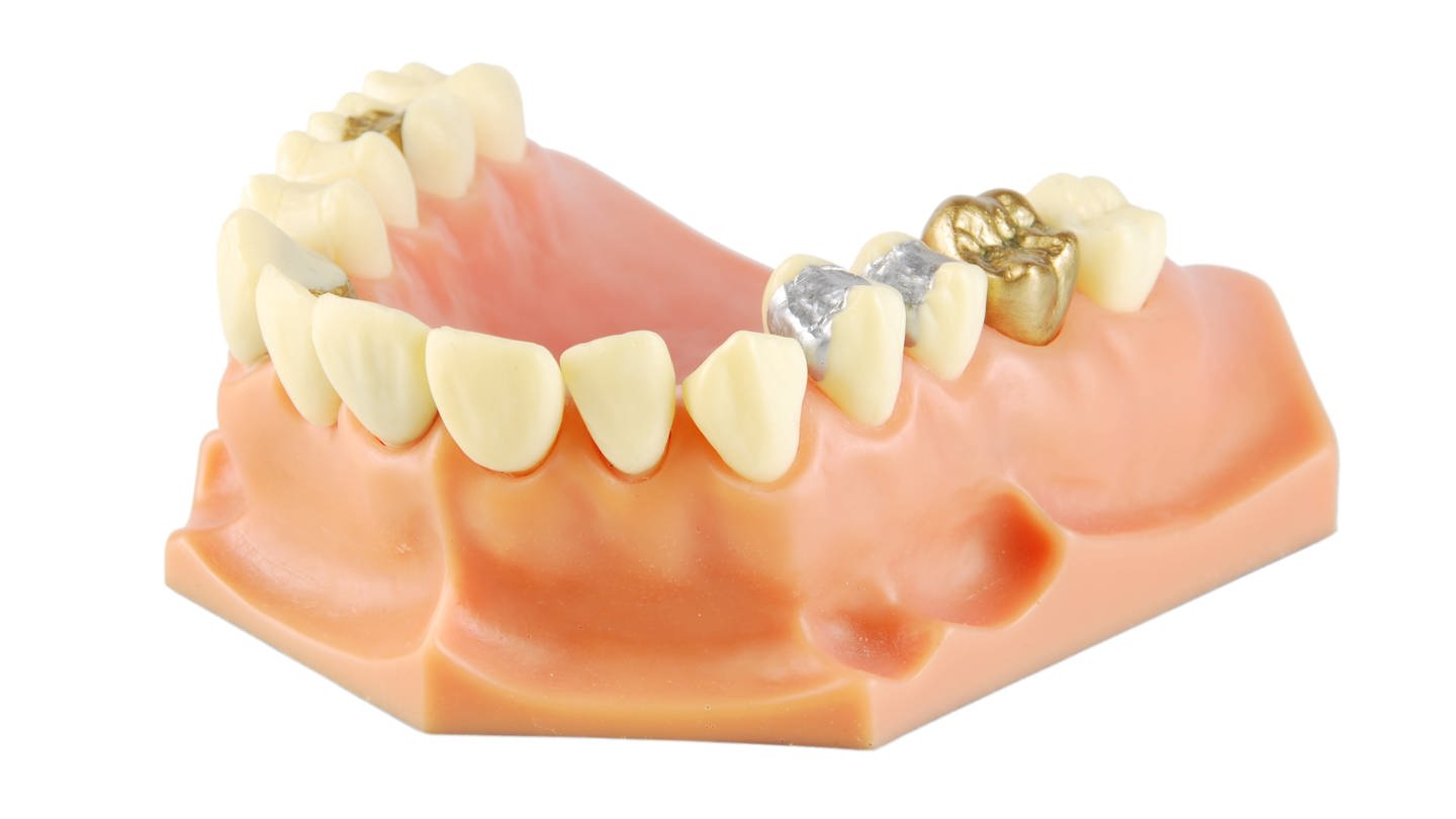 Zahnmodell mit verschiedenen Behandlungen (Foto: Colourbox)