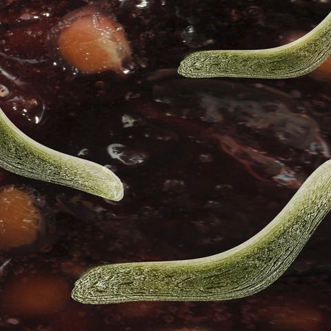 Bakterien im Darm (Foto: picture-alliance / Reportdienste, picture alliance/imageBROKER)