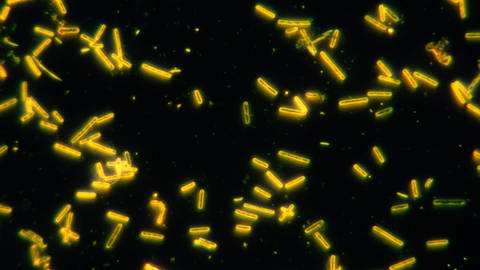 Mikroskopische Dunkelfeld-Aufnahme von Bakterien (Foto: SWR)
