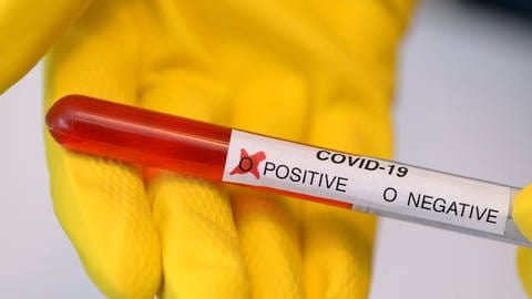 Beim bisherigen standardmäßig verwendeten Test auf das neue Coronavirus wird die Viren-RNA mithilfe eines speziellen Enzyms erst mal vervielfältigt (Foto: IMAGO, imago images/MiS)