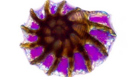 Vergrößerte Foraminifera (Foto: IMAGO, imago images / blickwinkel)