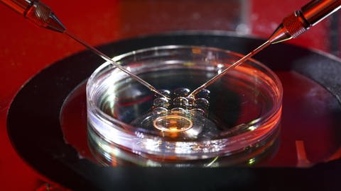 Künstliche Befruchtung nach der ICSI-Methode (Intrazytoplasmatische Spermien Injektion) unter dem Mikroskop (Foto: IMAGO, imago/Jochen Tack Center for Reproductive Medicine/ Interdisciplinary Center for Fertility )