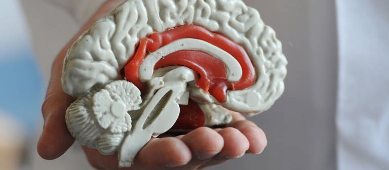 Das Modell von einem menschlichen Gehirn (Symbolbild) (Foto: dpa Bildfunk, picture alliance / dpa | Armin Weigel (Symbolbild))