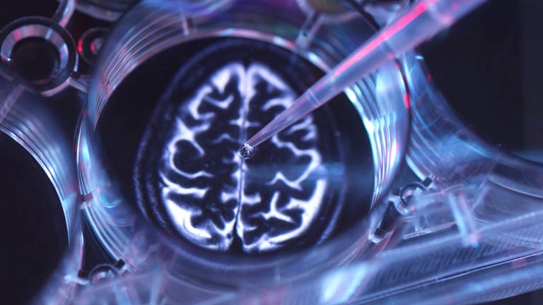 Illustrative Gehirnprobe im Labor (Foto: IMAGO, imago images/Westend61)