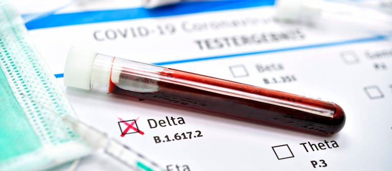 Blutprobe mit Coronavirus Delta-Variante B.1.617.2 (Foto: IMAGO, imago)