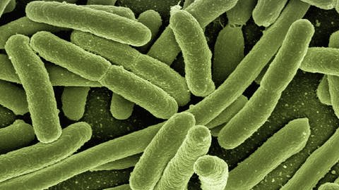 Escherichia coli (Foto: SWR, Pixabay)