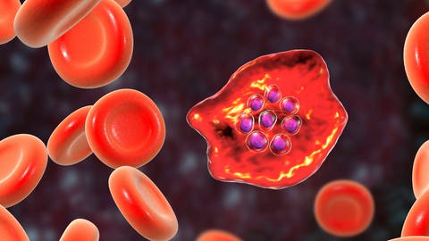 Die Malaria-Erreger zerstören die roten Blutkörperchen. Folge ist unter anderem hohes Fieber. (Computerillustration) (Foto: IMAGO, imago images/Science Photo Library)