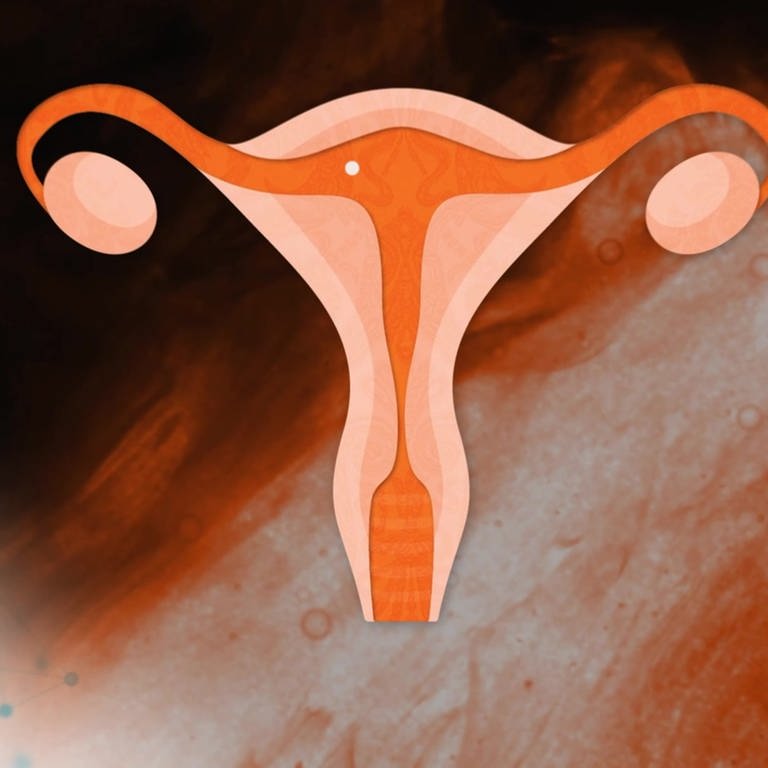 Schwangerschaftsabbruch ist in Deutschland nur unter bestimmten Voraussetzungen erlaubt. (Foto: Colourbox, SWR, Colourbox)