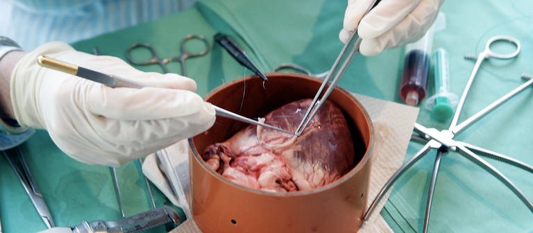 Hier wird für Versuchzwecke mit mikrochirurgischen Instrumenten an einem Schweineherz in der Uniklinik in Frankfurt am Main operiert.  (Foto: picture-alliance / Reportdienste, Cathrin Müller dpa/lhe)