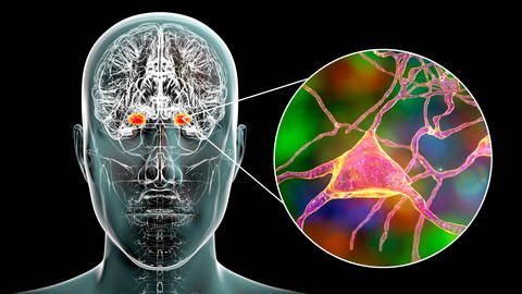 Die Amygdala ist eine von mehreren Gehirnregionen zur Emotionsregulierung (Foto: imago images, IMAGO / Science Photo Library)