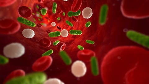 Darstellung einer bakteriellen Infektion des Blutes (Foto: IMAGO, imago stock&people)