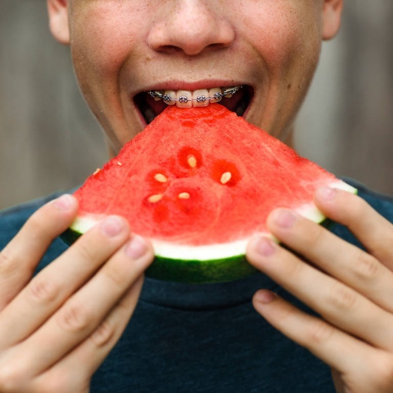 Nahaufnahme eines Munds mit Zahnspange, welcher in ein rotes Stück Melone beißt