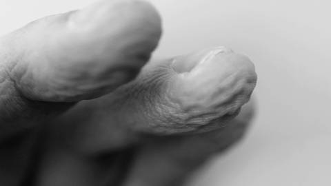 Verschrumpelte Finger in Schwarz-Weiß (Foto: IMAGO, marshi via www.imago-images.de)