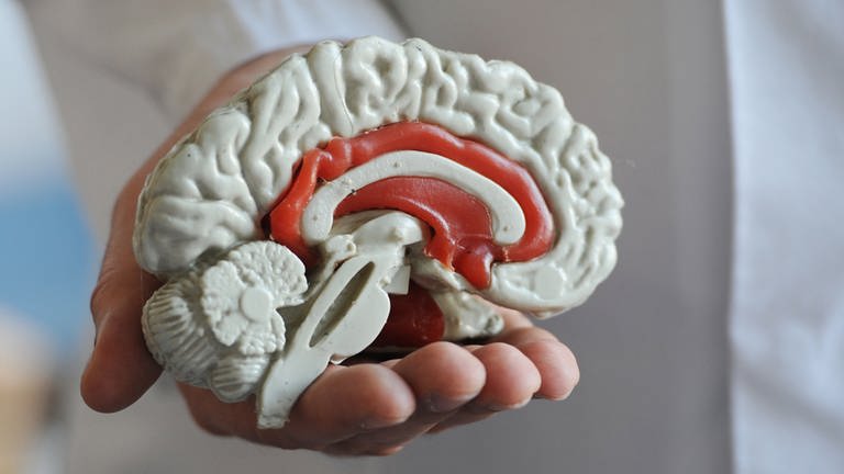 Das Modell von einem menschlichen Gehirn (Symbolbild) (Foto: dpa Bildfunk, picture alliance / dpa | Armin Weigel (Symbolbild))