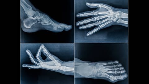 Röntgenaufnahme von Füßen und Händen (Foto: IMAGO, OZMedia via www.imago-images.de)