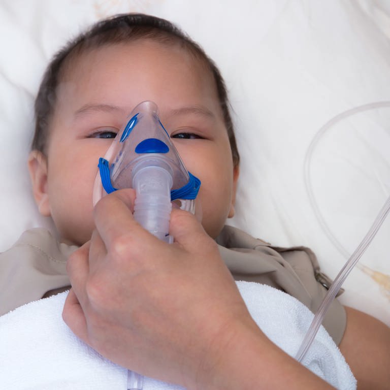 Baby mit RSV hängt an Sauerstoffmaske. (Foto: IMAGO, IMAGO / agefotostock)