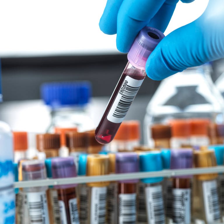 Forscher hält Blutprobe hoch (Foto: IMAGO, Westend61)