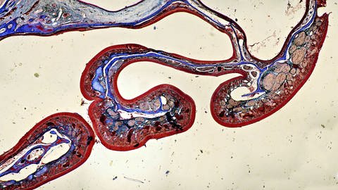 Menschliche Riechschleimhaut - die Nervenzellen in der Nase sind sehr empfindlich und können durch Viren möglicherweise zerstört werden. (Foto: IMAGO,  imago/blickwinkel)