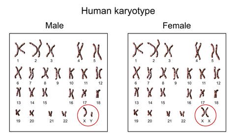 Männlichen und weiblichen Chromosomenuntersuchung, auch Karyotyp genannt. (Foto: IMAGO, /Science Photo Library)