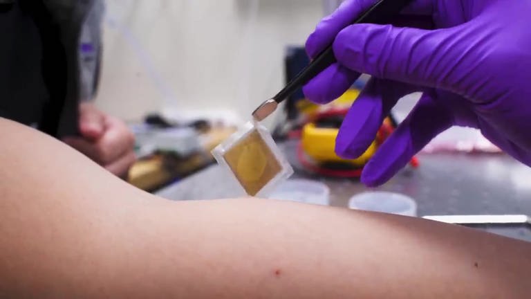 Ultraschallsticker ermöglicht Blick ins Körperinnere (Foto: Pressestelle, MIT)