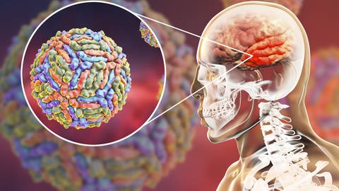 Das West-Nil-Virus kann unter anderem eine Enzephalitis auslösen, eine Entzündung bestimmter Bereiche des Gehirns. (Foto: IMAGO, imago images/Kateryna_Kon)
