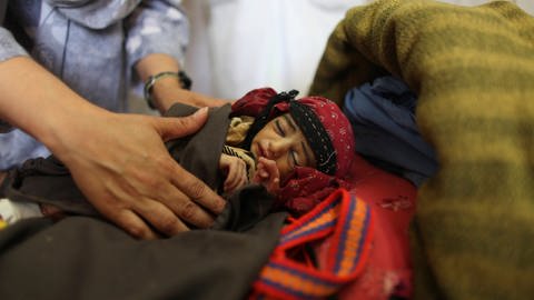 Mangelernährtes Baby in einer Geburtenklinik in Afghanistan.  (Foto: IMAGO, IMAGO / VWPics)