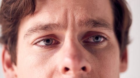 Mann mit glasigen Augen runzelt die Stirn. (Foto: IMAGO, IMAGO / Shotshop)
