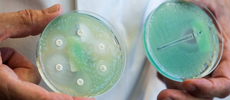 Petrischalen mit sogenannten Krankenhauskeimen, die Mehrfachresistenzen gegenüber Antibiotika aufweisen. (Foto: picture-alliance / Reportdienste, picture alliance/dpa | Armin Weigel)