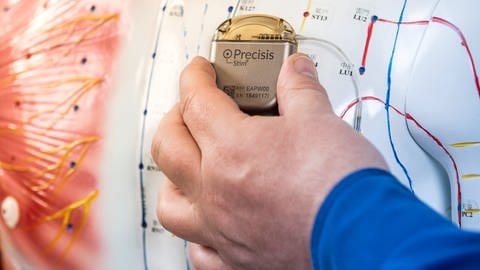 Der am Körper-Rumpf implantierte Stromgenerator versorgt den Hirnschrittmacher mit dem nötigen Strom. (Foto: Pressestelle, Precisis GmbH)