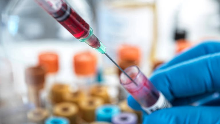 Laborarbeitender füllt eine Blutprobe aus einer Spritze in ein Probenglas. (Foto: IMAGO, IMAGO / Westend61)