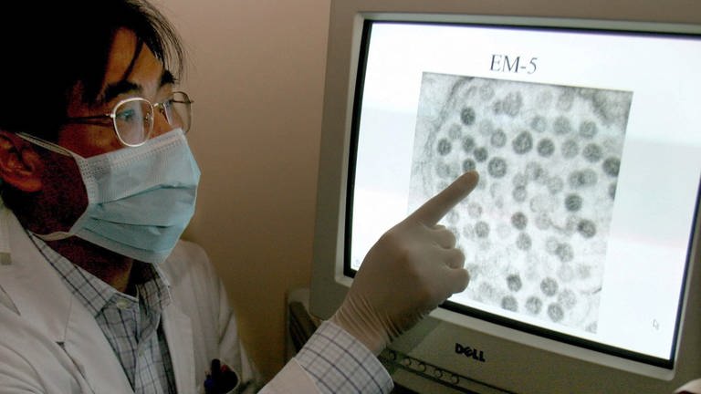 Dr. Chan Kwok Hung vom Mary Hospital in Hong Kong zeigt am 1. Mai 2003 den für die Seuche Sars verantwortlichen Coronavirus. (Foto: dpa Bildfunk, dpa | epa Paul Hilton)