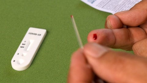 Es gibt mittlerweile auch Selbsttests, mit denen man Corona-Antikörper im Blut nachweisen kann. Die klassischen Methoden, z.B. einen PCR-Test, können diese Tests jedoch nicht ersetzen. (Foto: IMAGO, imago images/MiS)