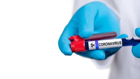 Grippeviren und Coronaviren unterscheiden sich grundlegend. Deshalb schlagen Coronatests auch nicht auf Grippeviren an.