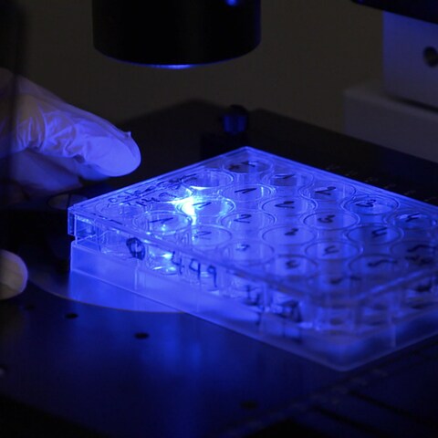 Strahlenmediziner untersuchen Knochenmarkszellen am Mikroskop (Foto: SWR)