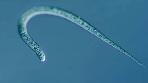 Lichtmiskropische Aufnahme eines Fadenwurms. An Fadenwürmern, sogenannten Nematoiden, lässt sich die Bildung von Ablagerungen gut beobachten.   (Foto: IMAGO, imago/blickwinkel/F.Fox)