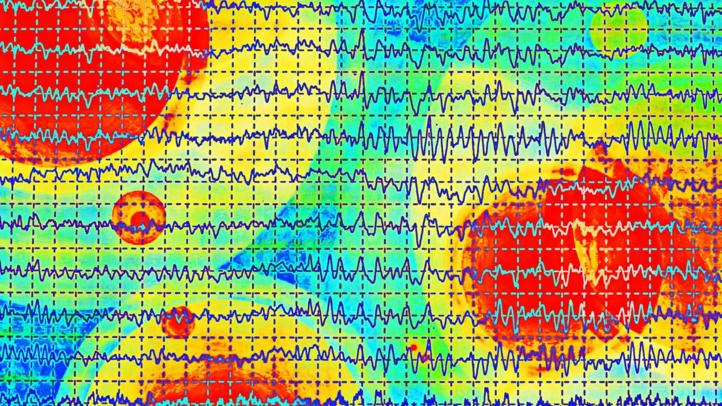 EEG eines Parkinson-Patienten (Foto: IMAGO, IMAGO / agefotostock)