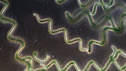 Spirulina sind Süßwasseralgen und eine Gattung der Cyano-Bakterien, früher auch als "Blaualgen" bezeichnet. (Foto: IMAGO, imago images / Nature Picture Library)
