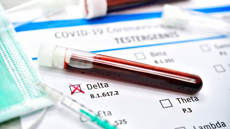 Blutprobe mit Coronavirus Delta-Variante B.1.617.2 (Foto: IMAGO, imago)