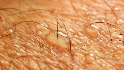 Der Schweißgeruch auf der Haut trägt unter anderem dazu bei, wie sehr uns Mücken anziehend finden. (Foto: IMAGO, IMAGO / imagebroker/möbus)
