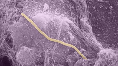 Mikroskopische Aufnahme von fadenförmige Bakterien aus dem Urin einer Frau mit Blasenentzündung (Foto: picture-alliance / Reportdienste, picture-alliance/ dpa | PloS Medicine/David Rosen)