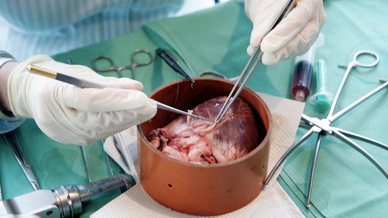 Hier wird für Versuchzwecke mit mikrochirurgischen Instrumenten an einem Schweineherz in der Uniklinik in Frankfurt am Main operiert. 
