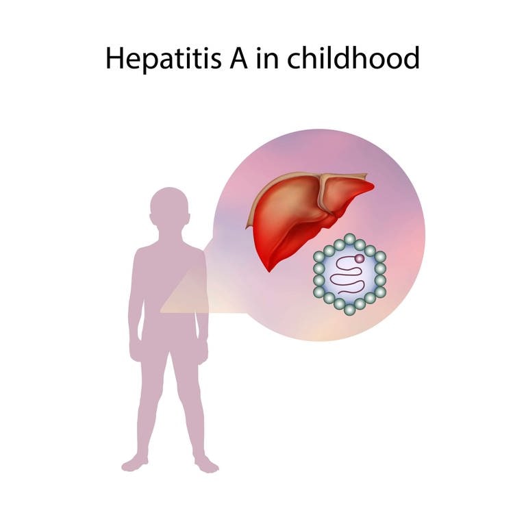 In letzter Zeit gab es einige Hepatitis-Fälle bei Kindern.  (Foto: IMAGO, imago)